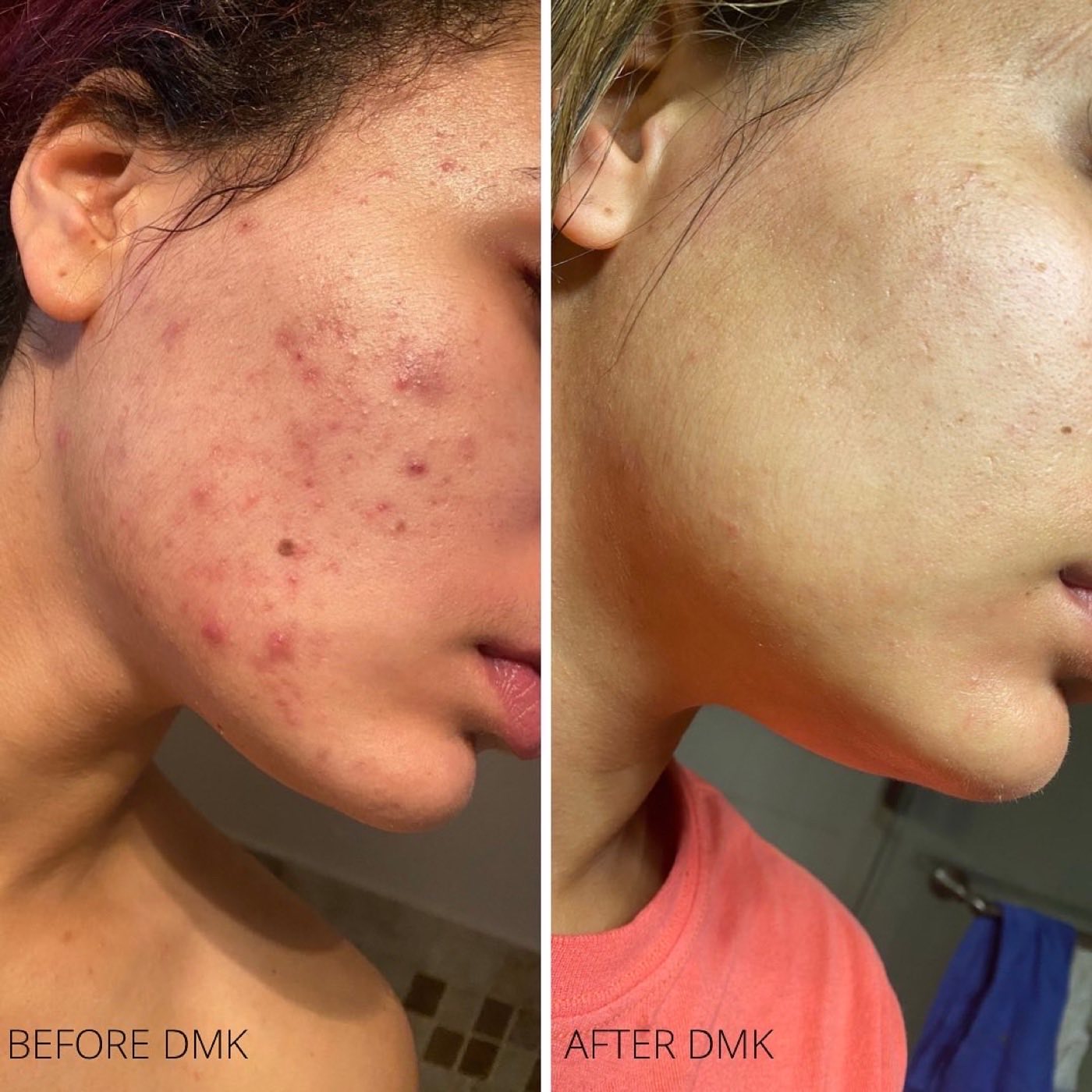 Pachi Aesthetics in Islip, New York